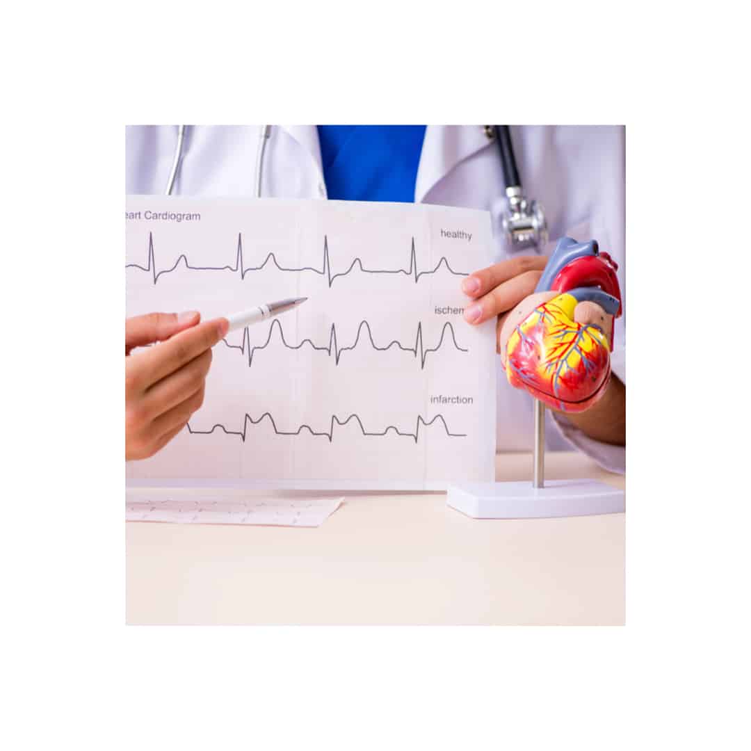 medico cardiologo muestra un electrocardiograma de un paciente con disfunción eréctil